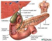 gallstones1 - Gallstones