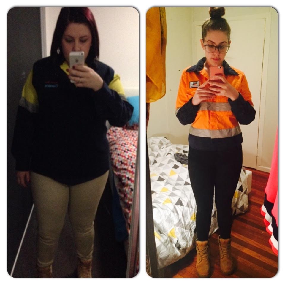 Stacey Before and After Gastric Sleeve Surgery